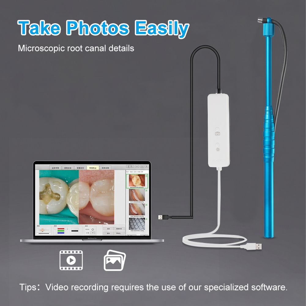 5MP Micro Intraoral Camera Den - Mini Electronics Gadgets review and price